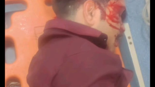 MANT-यमुना एक्सप्रेसवे पर बाइक बनी हादसे का शिकार, एक की, हालत गंभीर,,