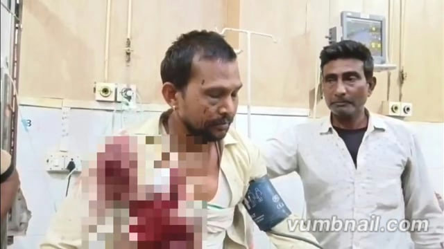 मथुरा में दबंगों के हौसले बुलंद! मामूली विवाद में युवक को मारी गोली, हालत गंभीर