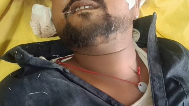 अंबेडकर नगर शवगृह में रखी लावारिस लाश की नहीं हो सकी शिनाख्त पहचान बताने के लिए इस नंबर पर करें संपर्क
Mo.9598379733