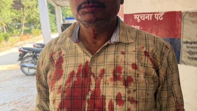 ऑडियो वायरल करने के विवाद में युवक पर हमला, लाठी-डंडों और तलवार से मारपीट कर किया घायल#latest_news 