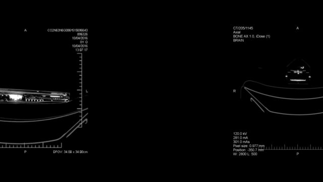 Náhled pro video reference