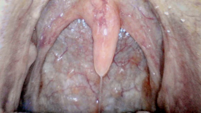 Uvula