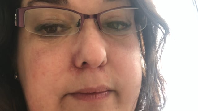 Frances' Story — Panic Attacks & GAD