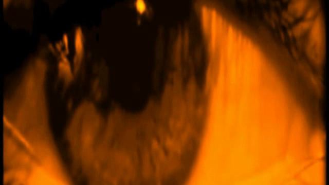 Vermibus - Teaser