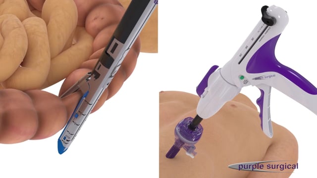 Vimeo video thumbnail