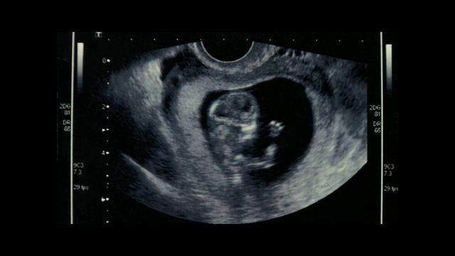 El análisis ley Esther