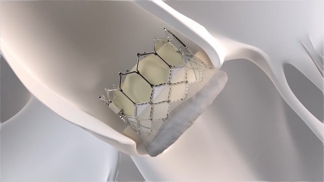 Video poster image