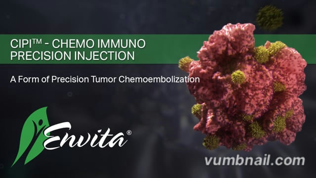 Cpi Injection Meaning Chemo Immuno Precision Injections (CIPI™) Treatment