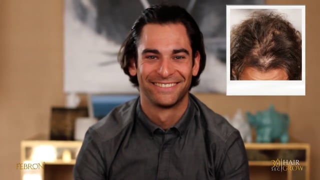 Febron Hair Fibers customer testimonial showing fuller-looking hair before and after result