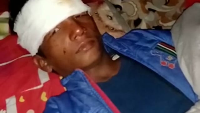 साइकिल से गिरकर एक बच्चा जख्मी इलाज के लिए कराया गया भर्ती।