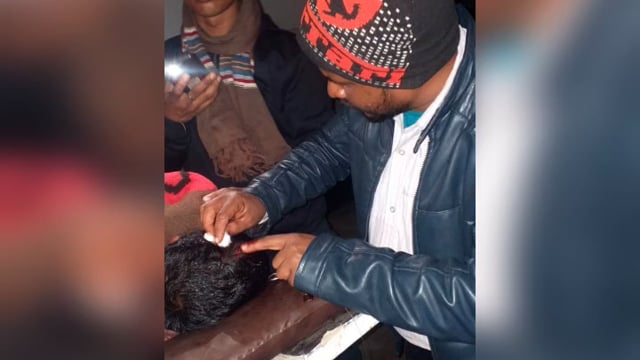 पैर फिसलकर गिरने से एक व्यक्ति हुआ घायल, किया गया रेफर