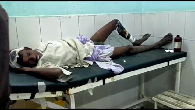 लखीसराय रेलवे स्टेशन पर ट्रेन से गिरकर युवक हुआ जख्मी बेहतर इलाज हेतु ले जाया गया लखीसराय सदर अस्पताल