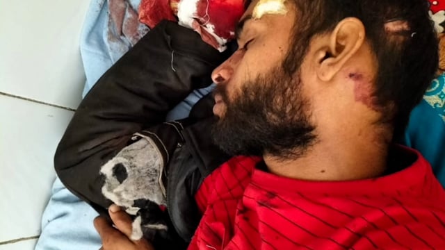 अनुग्रह नारायण रोड स्टेशन पर ट्रेन से उतरते वक्त गिरकर घायल हुआ युवक, बेहतर इलाज के लिए किया गया रेफर