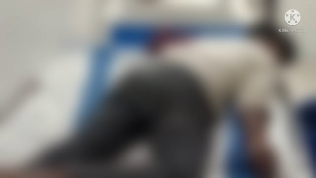 रहुई इलाके  इमली बिगहा में कुत्ते ने अधेड़ को काटा।