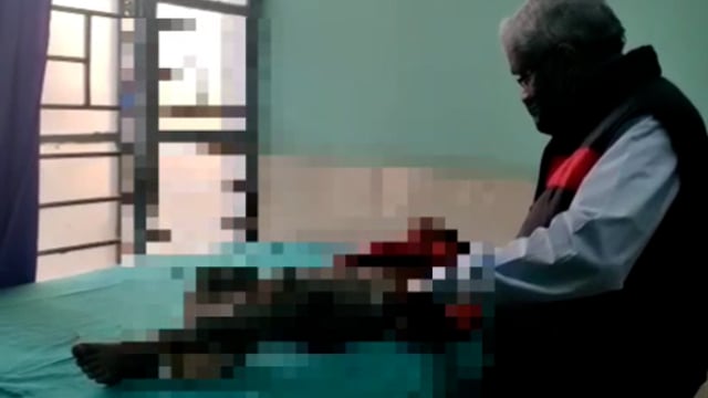 रफीगंज सड़क दुर्घटना में 5 वर्षीय बालक हुआ घायल हालत बनी नाज़ुक।