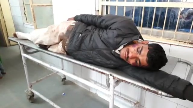 बाईपास के ओवरब्रिज के समीप बोलेरो ने बाइक सवार भाई बहन को मारी टक्कर,गंभीर हालत में सदर अस्पताल से इलाज के बाद रेफर