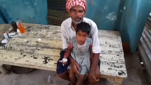 चारा काटने वाली मशीन से बच्ची का कटा हाथ।