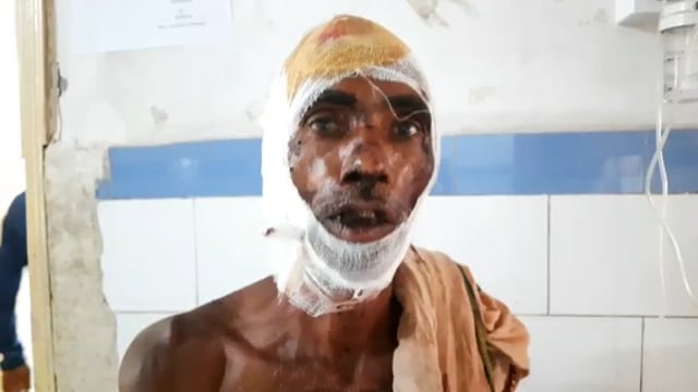 मदनपुर के गुलाब बिगहा गांव में सड़क पर नाली के पानी को बहाने को लेकर दो पक्ष भिड़े, तीन घायल