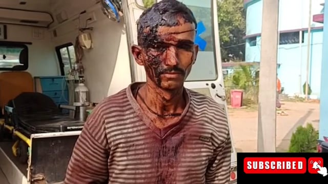 मारपीट कर जख्मी करने का आरोप