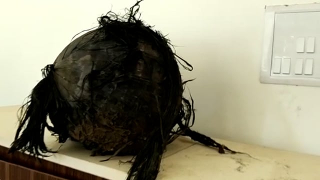 जिल्ह्यातील सॅटलाईट चा सहावा गोळा खडसंगी वनपरिषेत्रातील तळोधी बिटातील वन तलावात आढळला