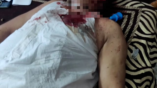 मसौढी मे दो बेवसाईयो को अज्ञात बदमाशों के द्वारा मारी गई गोली