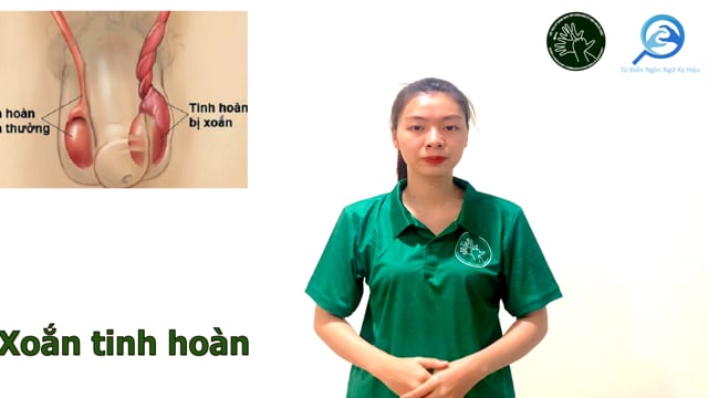 xoan-tinh-hoan-7755