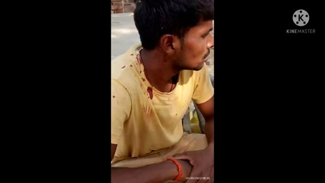 प्रतापगढ़ जिले के कुंडा थाना क्षेत्र के पिंगरी गांव में जबरन पेड़ काटने को लेकर हुआ विवाद जमकर हुई मारपीट चल रहा इलाज