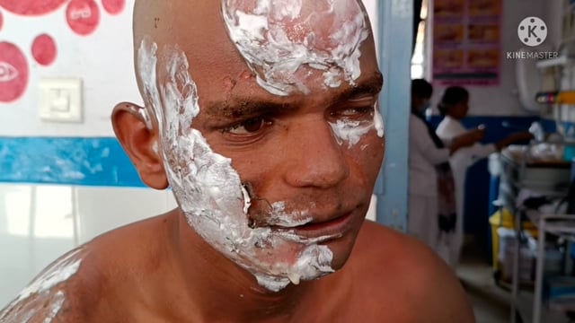 राजा रानी तालाब के पास खुदरा पेट्रोल विक्रेता के दुकान में लगा आग जिसमें दुकानदार सहित 5 लोग बुरी तरह  घायल