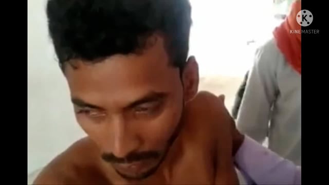 बाइक दुर्घटना में करशॉप शंभूगंज का एक युवक जख्मी प्राथमिक उपचार के बाद भागलपुर रेफर