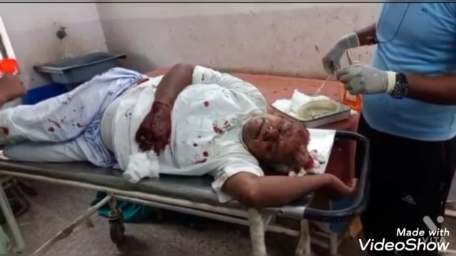 अनियंत्रित ऑटो ने पीछे से स्कूटी में मारी ठोकर स्कूटी चालक गंभीर रूप से हुए घायल