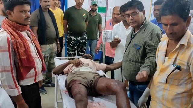 बल्थर गांव के समीप बाइक सवार अपराधी ने ठेला चालक के पैर में गोली मारकर किया घायल,सदर अस्पताल में भर्ती