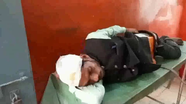 राजापुर गांव में आपसी विवाद में साला ने बहनोई  को मारपीट कर किया जख्मी