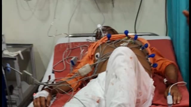 जिले के भाजपा के नगर विधायक का मधुबनी के सकरी के समीप सड़क दुर्घटना