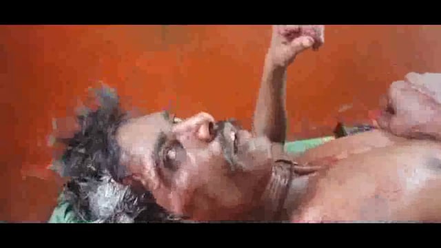 बनियाचक गांव में हुए जमीन विवाद को लेकर भाई ने भाई को पीट कर किया जख्मी