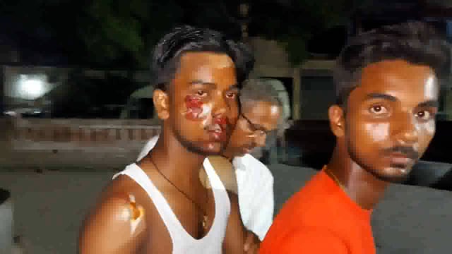 सीतापुर के अमीरगंज स्टेशन के सामने बाइक से टकराया शराबी अनियंत्रित बाइक पलटी बाइक सवार घायल CHC में भर्ती 