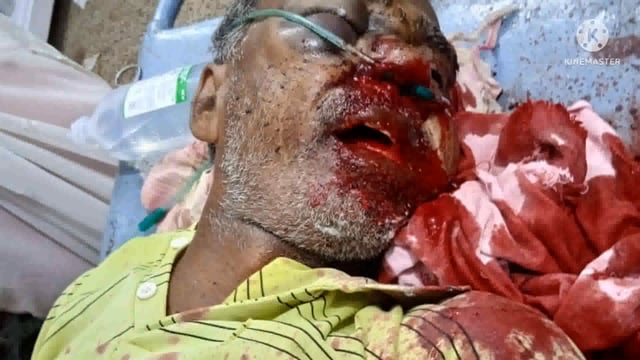 बेलहर गोरगावा के पास मोटरसाइकिल और साइकिल की जोरदार टक्कर से व्यक्ति जख्मी, इलाज के दौरान मौत, शव की नहीं हो पाई पहचान