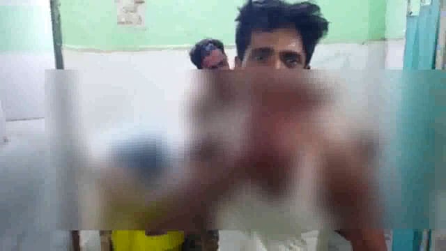 सिरौली चौराहे पर पैसो के विवाद में दो पक्षों में हुई जमकर मारपीट धारदार हथियार से किया गया हमला ।