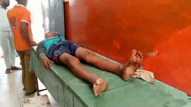 विशम्भरचक गांव में अमरूद के पेड़ से गिरकर एक 12 वर्षीय बालक हुआ जख्मी