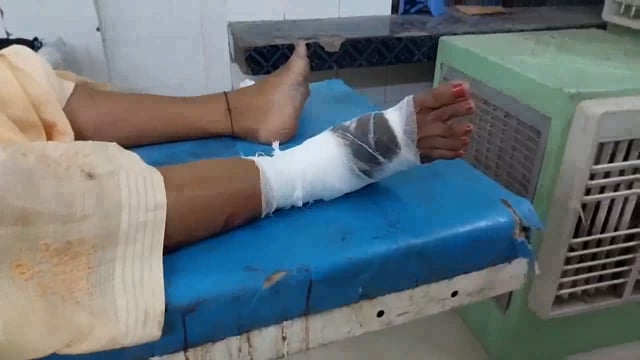 इमामगंज लौटने के दरमियां रही रोड मे टोटो पलट जाने से एक महिला हुई जख्मी इलाज के लिए लाया गया सदर अस्पताल।