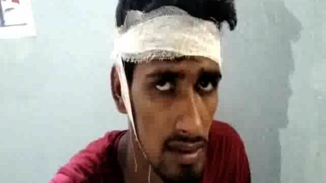 हिलसा के योगीपुर बाजार में खरीदारी करने गए युवक को बदमाशो ने मारपीट कर किया घायल,मामले की जांच में जुटी पुलिस