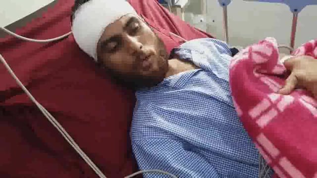 कल्याण के हाजी मलंग रोड पर 5050 ढाबा के पास आपसी झगड़े को लेकर दो गुटों में हुई मारपीट