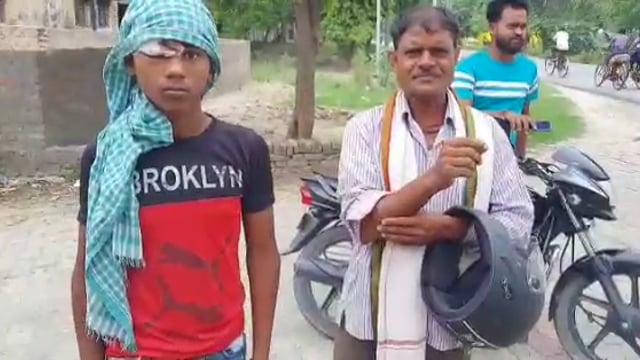 नवाबगंज क्षेत्र के नवादा गांव में पागल सियार का आतंक कई लोगों को काटकर किया घायल