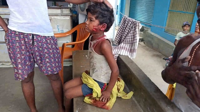 ऑटो की चपेट में आने से मनीष मलिक हुए घायल