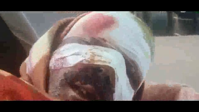 तारड़ीह गांव के समीप बेखौफ अपराधियों ने व्यवसाई से मारपीट कर नकदी छीना व्यवसाई गंभीर रूप से जख्मी