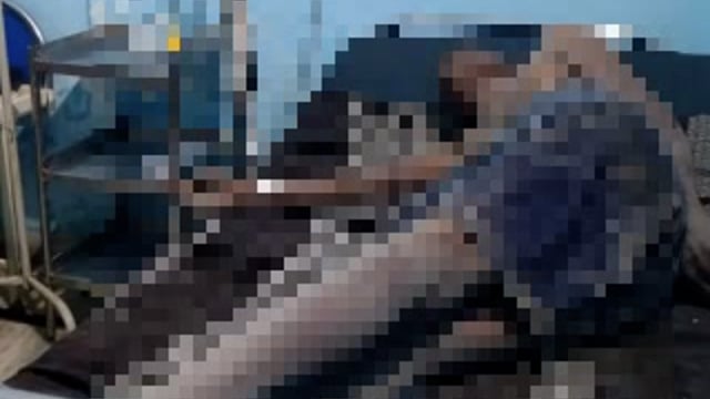 चुनार मिर्जापुर: लटके हाईटेंशन तार के चपेट में आने से मजदूर बुरी तरह झुलस गया