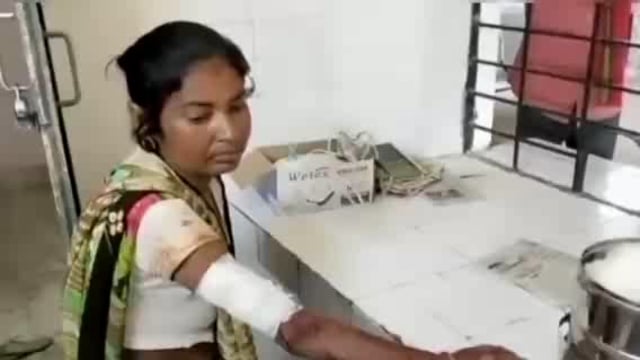 सुजौली इलाके के गड़रियनपुरवा में जंगली जानवरने महिला पर किया हमला, पहुँचाईगयी अस्पताल