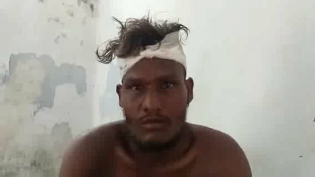 ₹50 बकाया को लेकर एक युवक को चार लोगों ने मिलकर फोड़ा सर#crime 