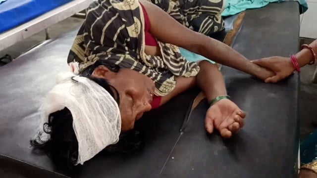 रामाटोला गांव में रास्ता विवाद को लेकर भाई भाई में हुई मारपीट एक भाई एक बहन सहित अन्य जख्मी