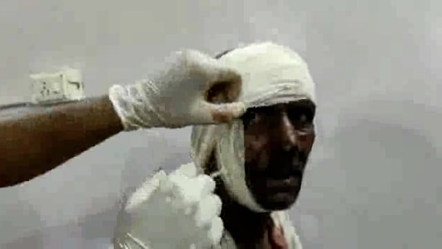 वेसवा में कलयुगी बेटे ने अपने पिता में मारी गोली सीएससी हॉस्पिटल लाया गया अलीगढ़ मेडिकल हॉस्पिटल किया रेफर