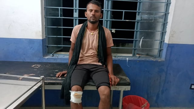 मारपीट कर किया गया जख्मी सूर्यगढ़ा सीएचसी में किया गया इलाज